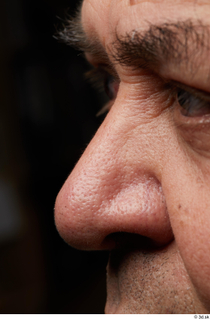 HD Face Skin Umberto Espinar eyebrow skin texture wrinkles 0001.jpg
